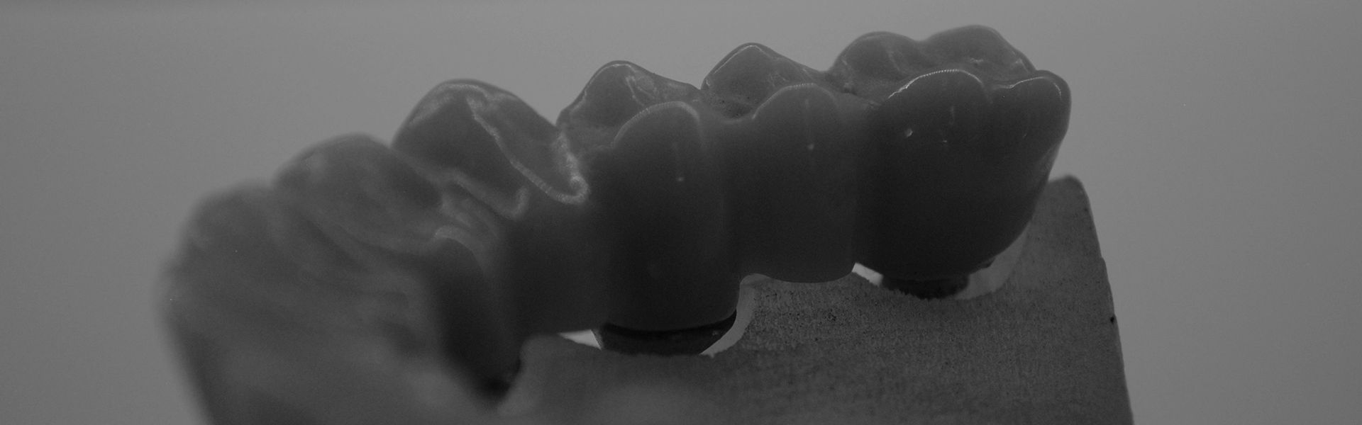 comparativas-gcam-graphenano-dental